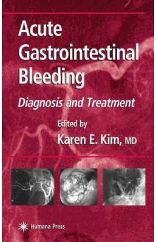 SD - Acute Gastrointestinal Bleeding:Diagnosis and Treatment - (HB)